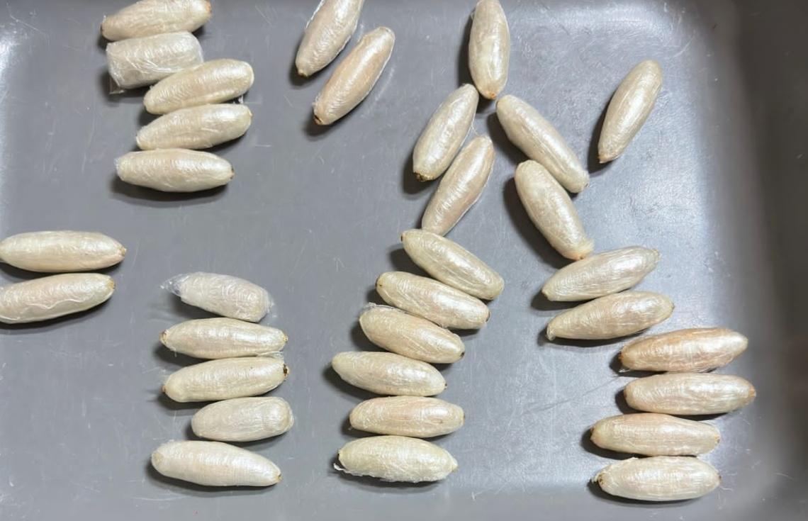 ޑްރަގް ބުލެޓްތަކެއް ދިރުވާލި މީހެއްގެ ހާލު ދެރަވެ އައިސީޔޫގައި ފަރުވާ ދެނީ