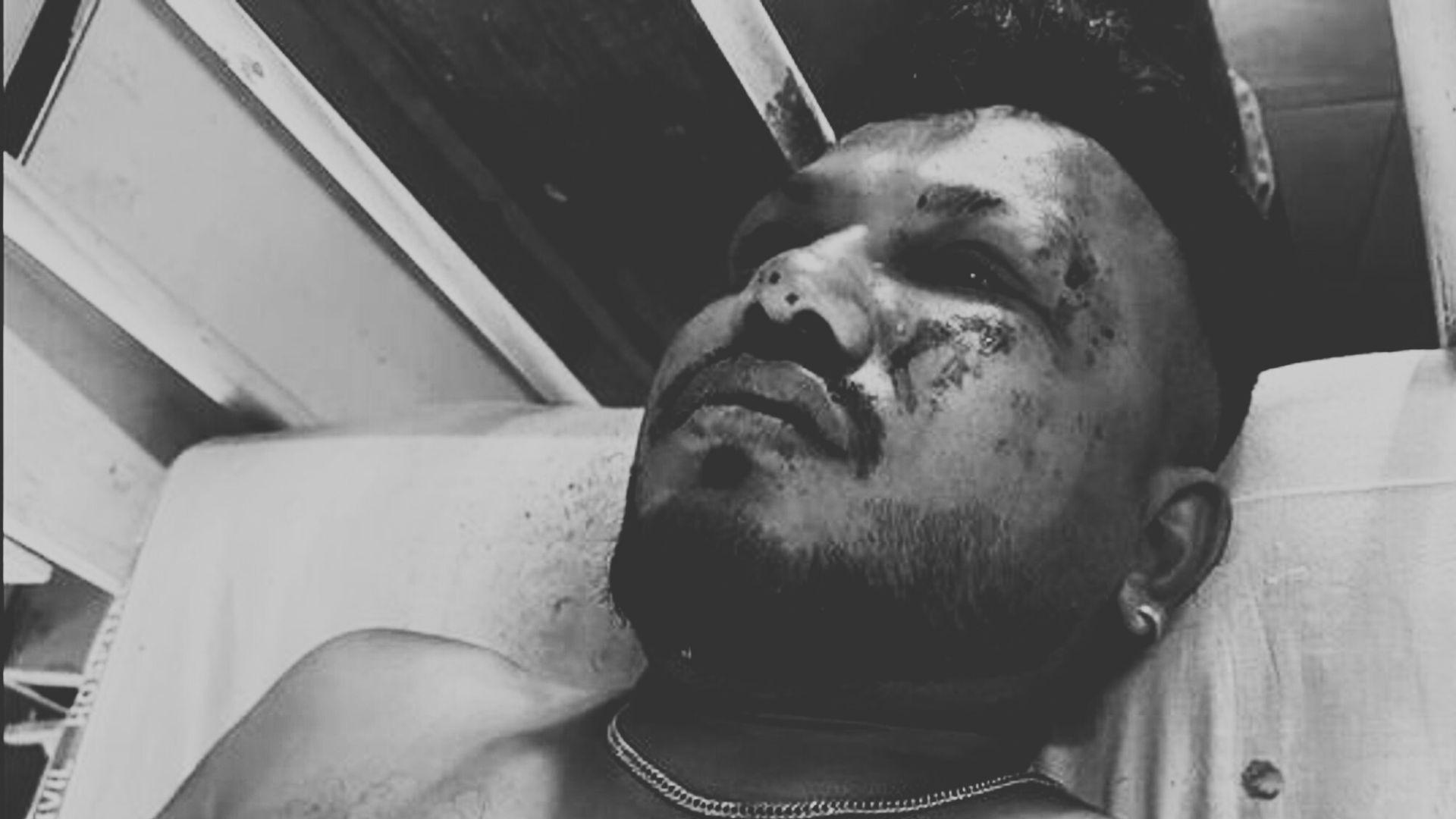 އެއާ އިންޑިއާގެ މަތިންދާބޯޓެއް ވެއްޓުން: ބޯޓުގައި ތިބި މީހުންގެ ތެރެއިން މިހާތަނަށް ސަލާމަތްވީ އެންމެ މީހެއް!