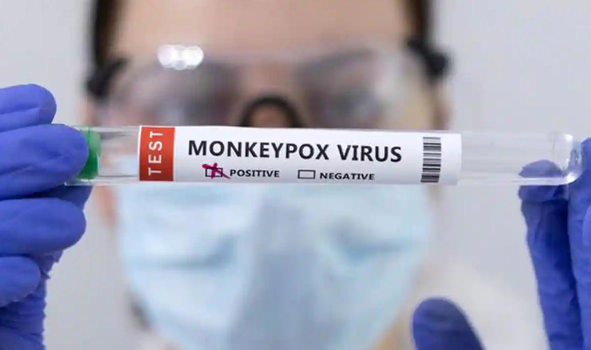 މަންކީޕޮކްސް އަށް އައު ނަމެއް ދެނީ