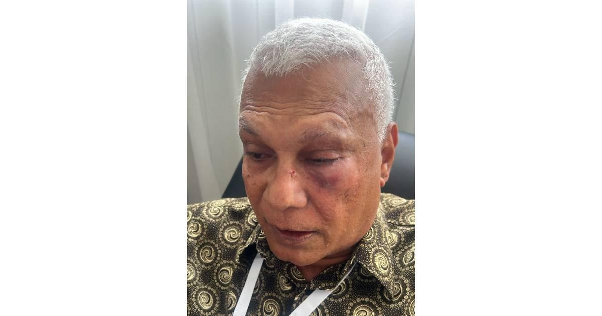 މެމްބަރު ޝަރީފަށް ހަމަލާދިން މައްސަލަައިގައި ޒުވާނަކު ހައްޔަރުކޮށްފި